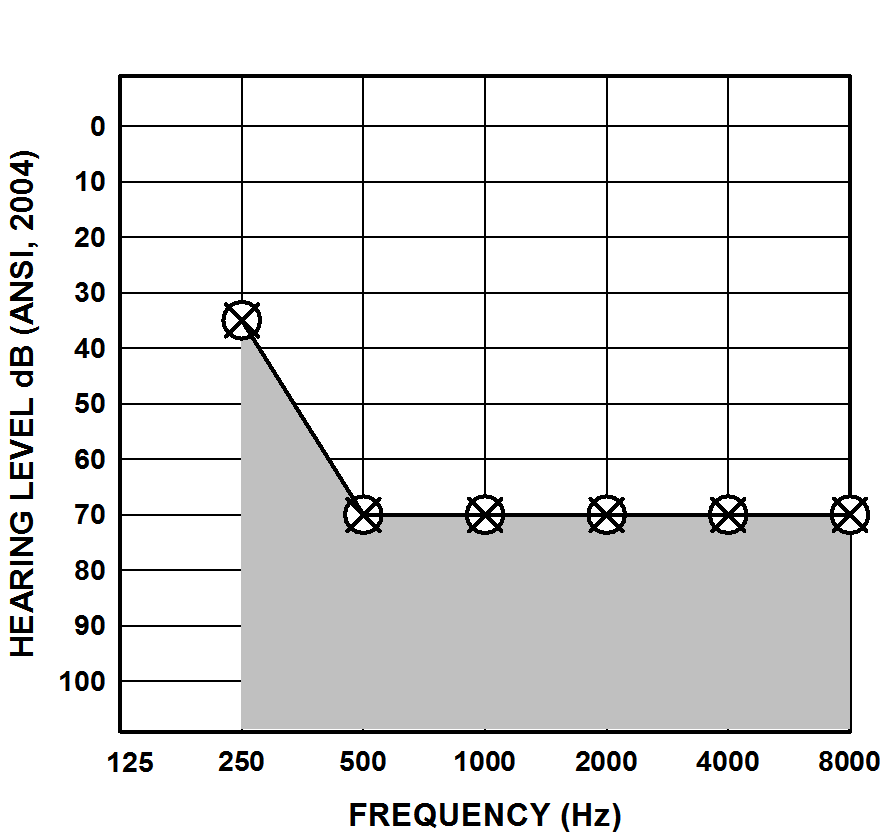 Typical Audiogram